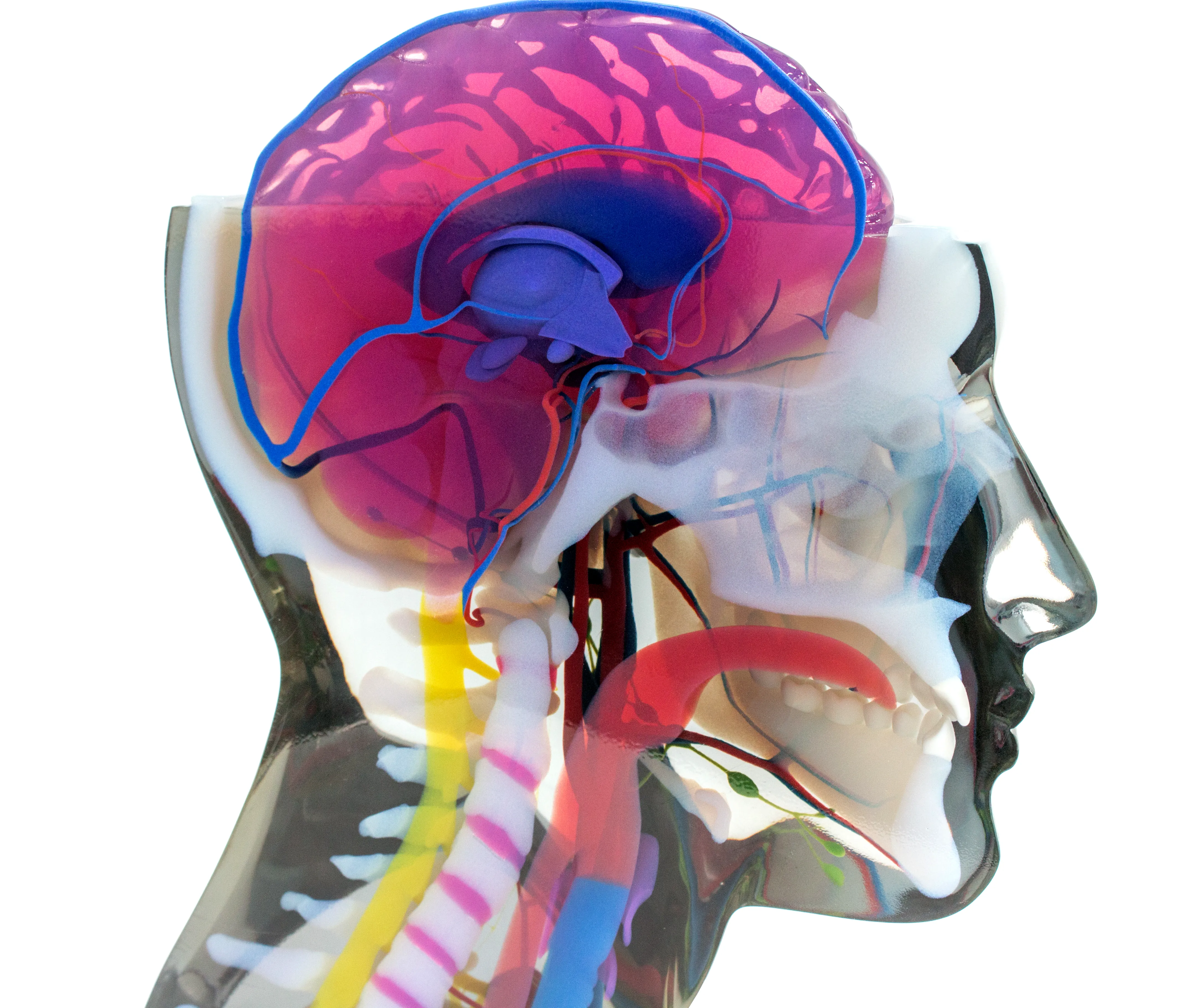 Stratasys j750 full color 3d printed medical human head